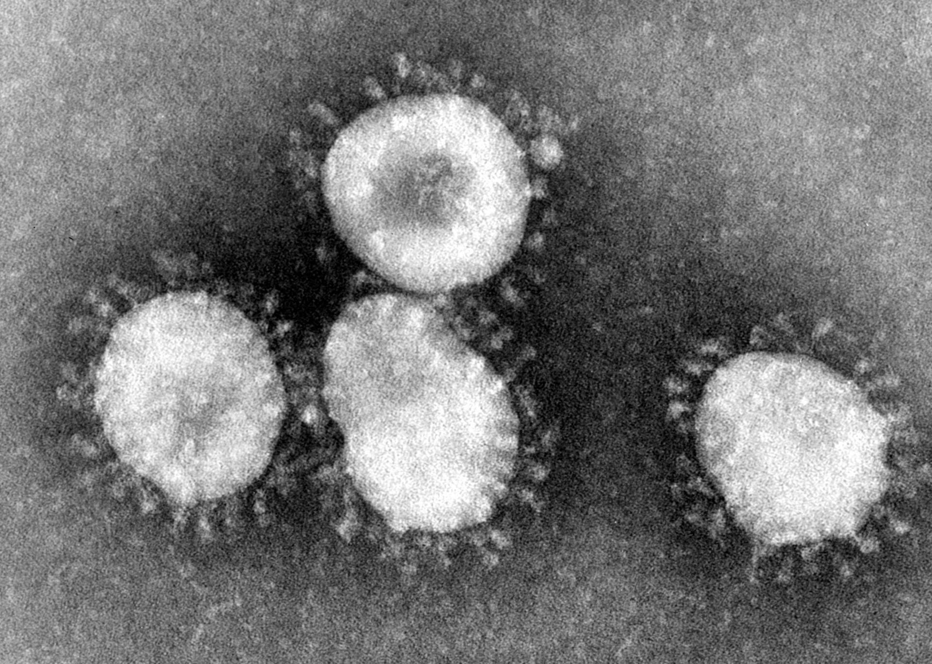 Overleden door Coronavirus